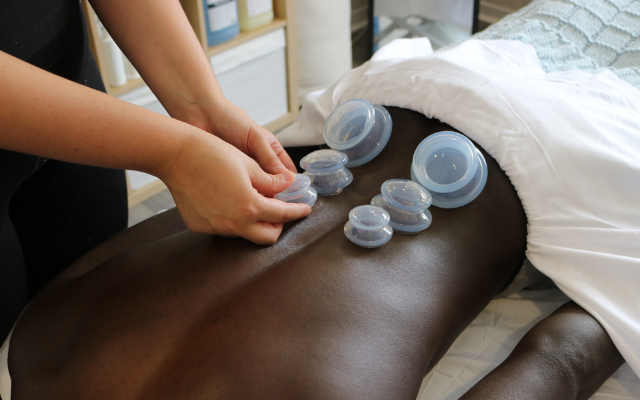 Maude Lauzon, massothérapeute, appliquant des ventouses sur le dos d’un client lors d’un Massage Sportif chez Myovex.